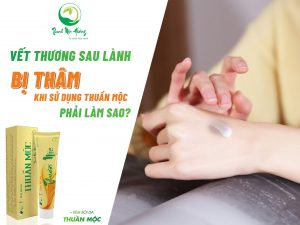 Kem Bôi Da Thuần Mộc trị vết thâm