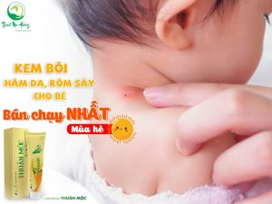 Kem Bôi Da Thuần Mộc trị muỗi đốt ở trẻ