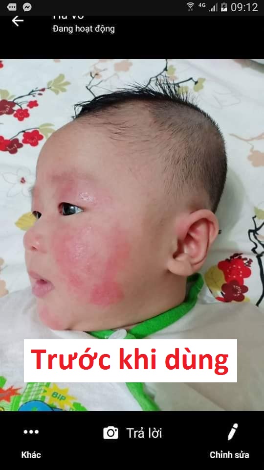 Phản hồi feedback Kem Bôi Da Thuần Mộc